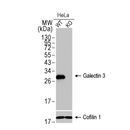 Galectin 3 antibody [HL1878] (GTX637627)